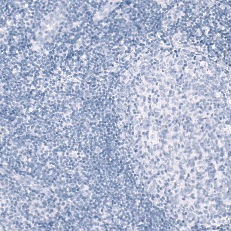 Myelin PLP Antibody (CL10622) - Azide and BSA Free Immunohistochemistry-Paraffin: Myelin PLP Antibody [NBP3-43977]