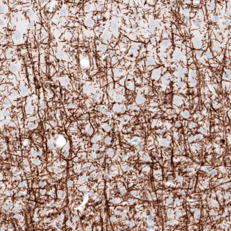 Myelin PLP Antibody (CL10622) - Azide and BSA Free Immunohistochemistry-Paraffin: Myelin PLP Antibody [NBP3-43977]