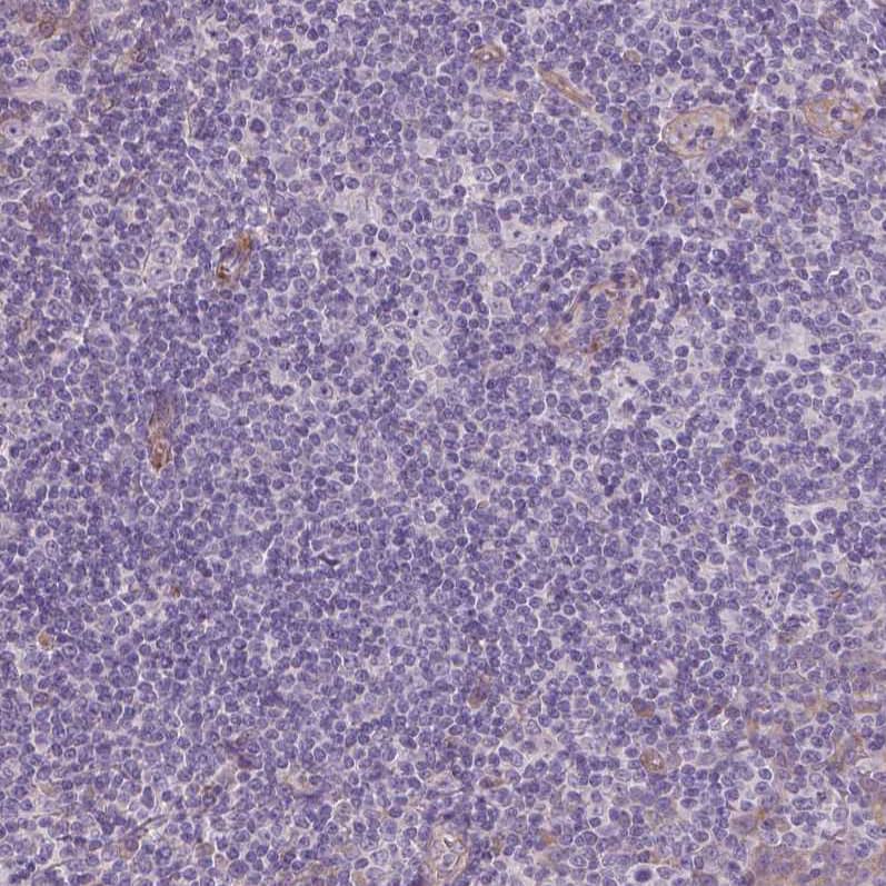 VEGFR1/Flt-1 Antibody (CL0345) - Azide and BSA Free Immunohistochemistry-Paraffin: VEGFR1/Flt-1 Antibody [NBP3-43978]