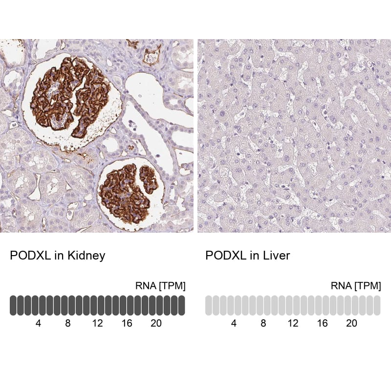 Podocalyxin Like Antibody (CL0284) - Azide and BSA Free Immunohistochemistry-Paraffin: Podocalyxin Like Antibody [NBP3-43980]