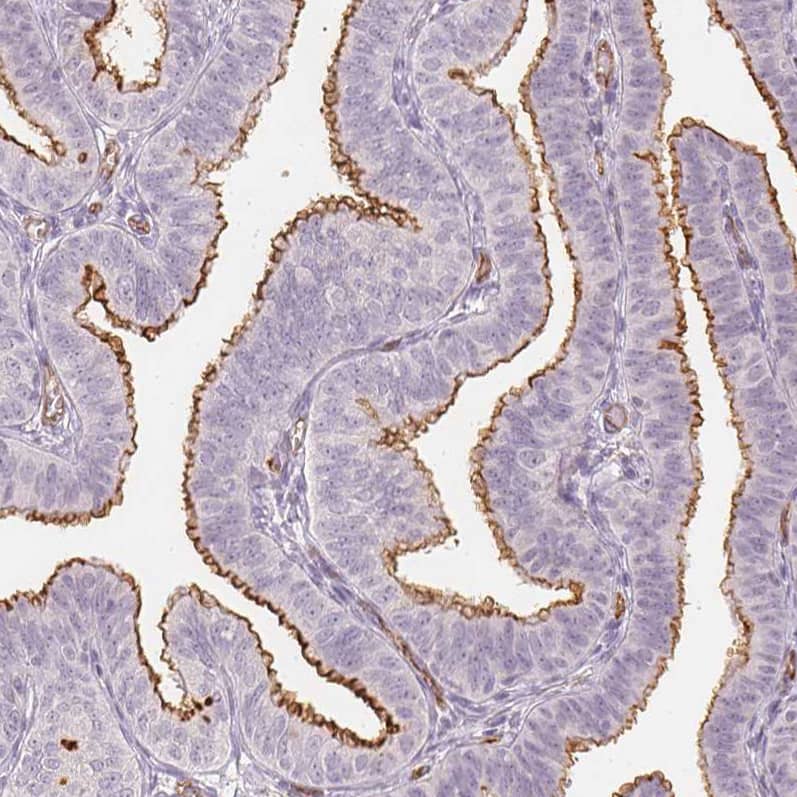 Podocalyxin Like Antibody (CL0284) - Azide and BSA Free Immunohistochemistry-Paraffin: Podocalyxin Like Antibody [NBP3-43980]
