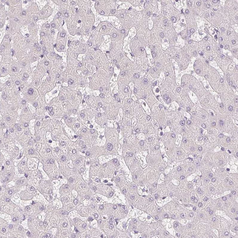 Podocalyxin Like Antibody (CL0284) - Azide and BSA Free Immunohistochemistry-Paraffin: Podocalyxin Like Antibody [NBP3-43980]