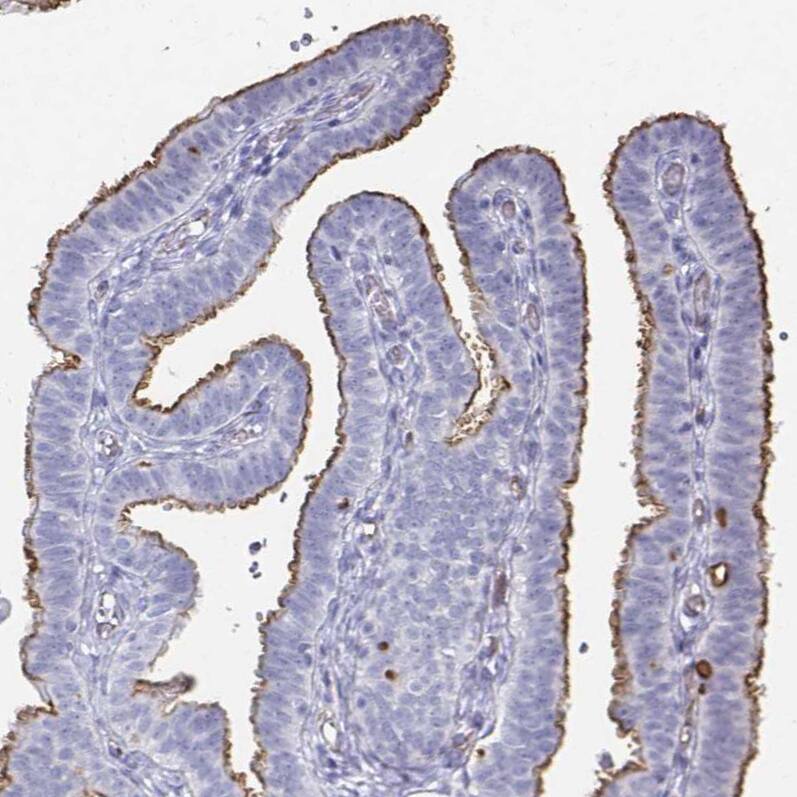Podocalyxin Like Antibody (CL0308) - Azide and BSA Free Immunohistochemistry-Paraffin: Podocalyxin Like Antibody [NBP3-43981]