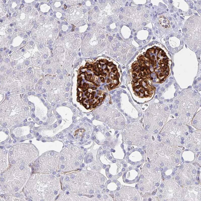 Podocalyxin Like Antibody (CL0308) - Azide and BSA Free Immunohistochemistry-Paraffin: Podocalyxin Like Antibody [NBP3-43981]
