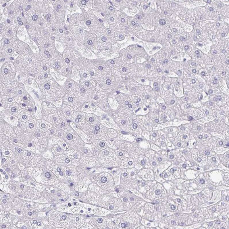 Podocalyxin Like Antibody (CL0308) - Azide and BSA Free Immunohistochemistry-Paraffin: Podocalyxin Like Antibody [NBP3-43981]
