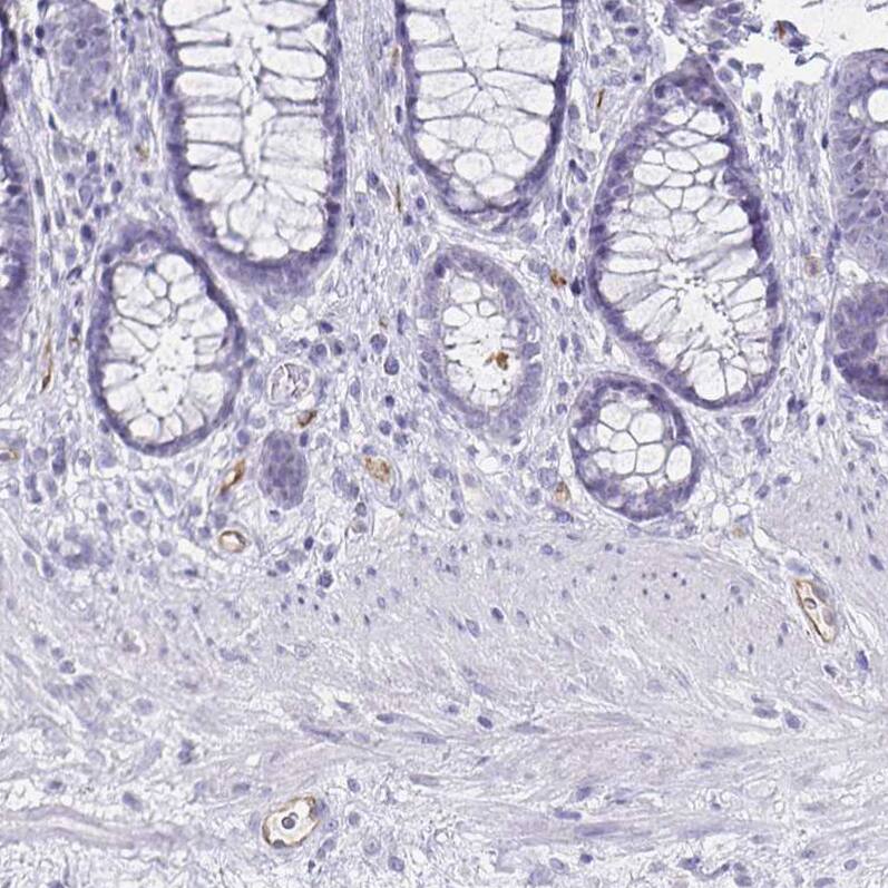 Podocalyxin Like Antibody (CL0308) - Azide and BSA Free Immunohistochemistry-Paraffin: Podocalyxin Like Antibody [NBP3-43981]