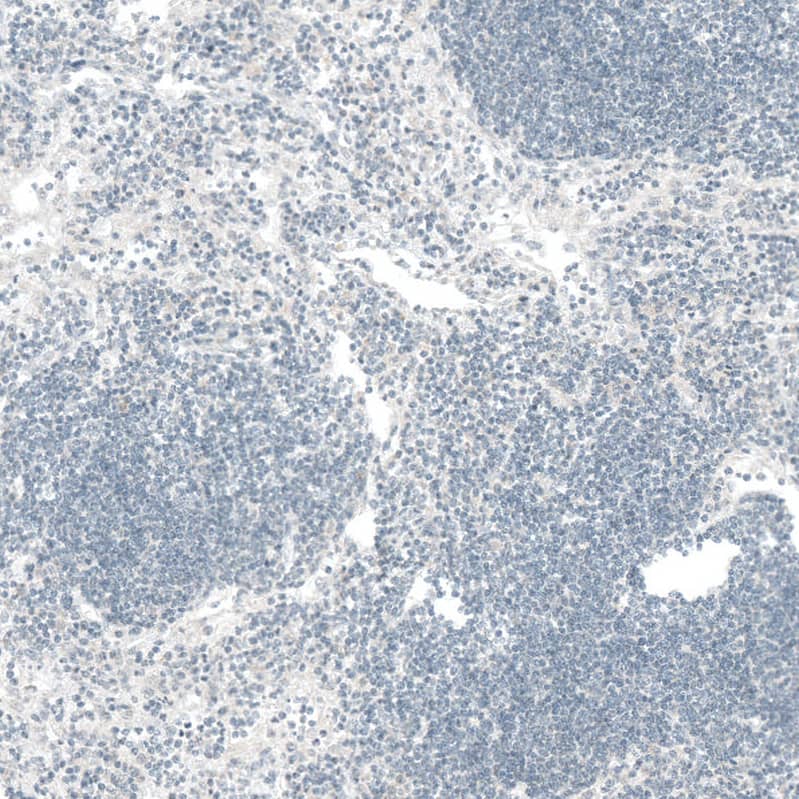 CTGF/CCN2 Antibody (CL5339) - Azide and BSA Free Immunohistochemistry-Paraffin: CTGF/CCN2 Antibody [NBP3-43982]
