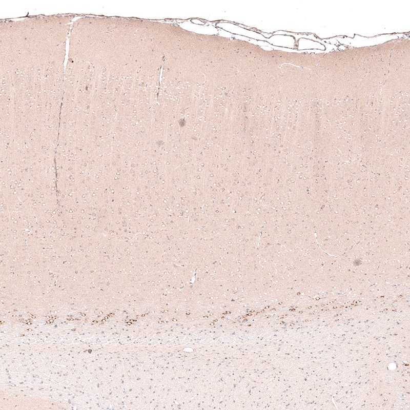 CTGF/CCN2 Antibody (CL5339) - Azide and BSA Free Immunohistochemistry-Paraffin: CTGF/CCN2 Antibody [NBP3-43982]