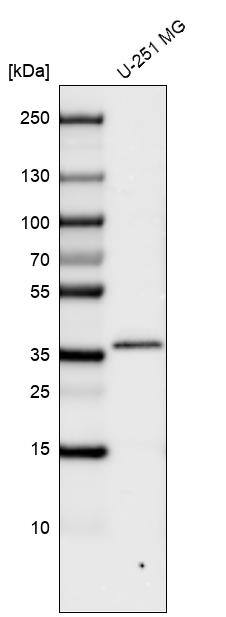 CTGF/CCN2 Antibody (CL5339) - Azide and BSA Free Western Blot: CTGF/CCN2 Antibody [NBP3-43982]