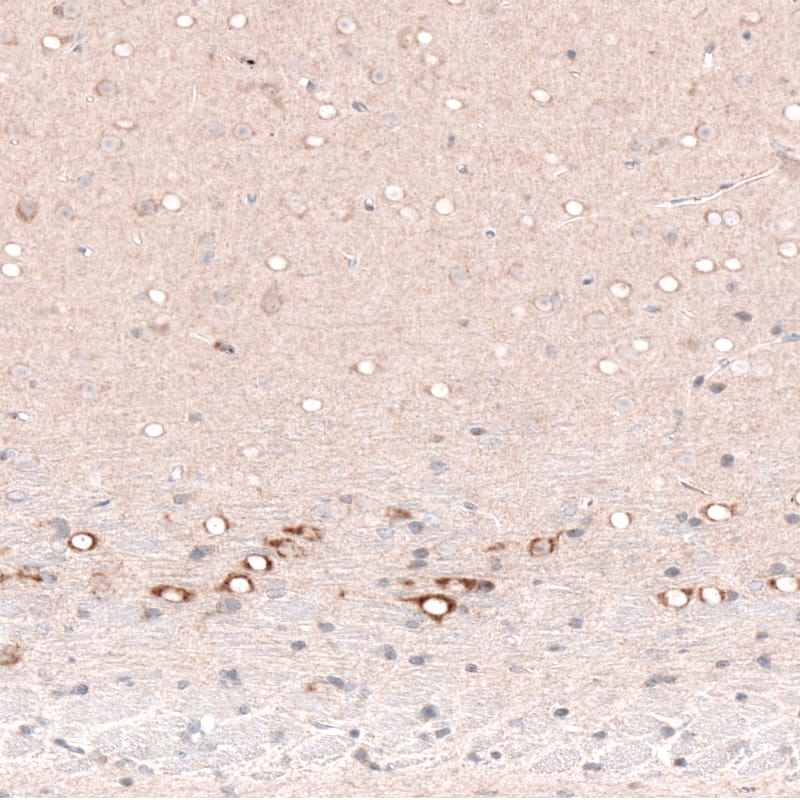 CTGF/CCN2 Antibody (CL5339) - Azide and BSA Free Immunohistochemistry-Paraffin: CTGF/CCN2 Antibody [NBP3-43982]