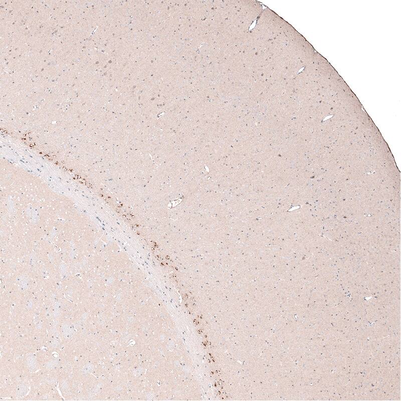 CTGF/CCN2 Antibody (CL5339) - Azide and BSA Free Immunohistochemistry-Paraffin: CTGF/CCN2 Antibody [NBP3-43982]