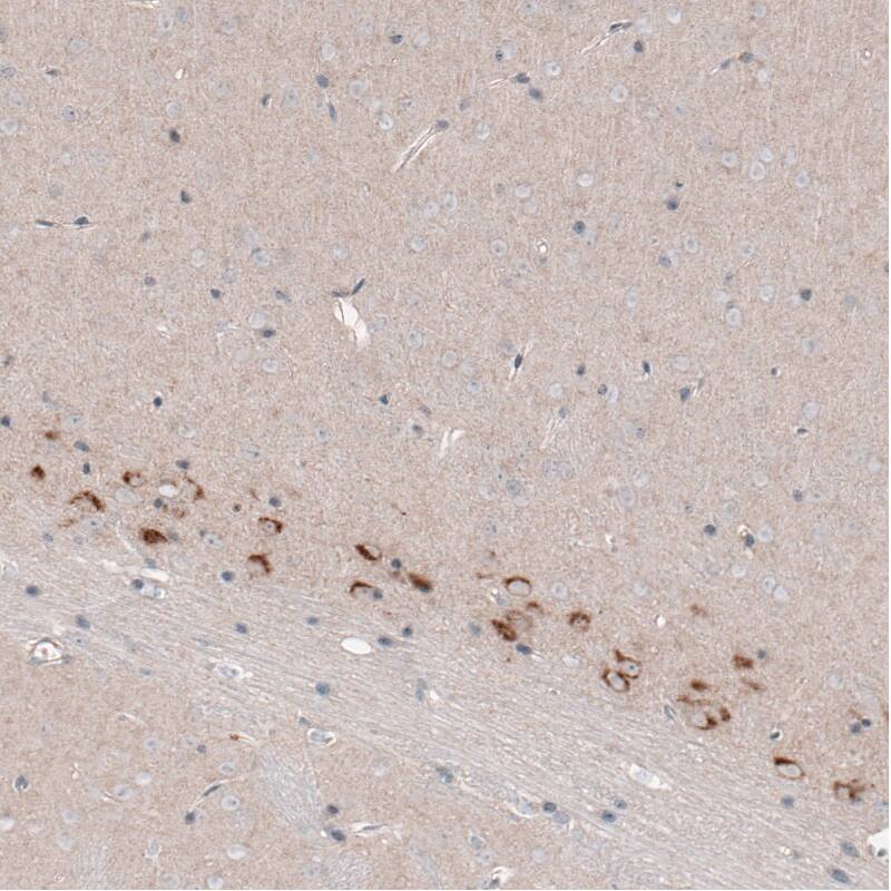 CTGF/CCN2 Antibody (CL5339) - Azide and BSA Free Immunohistochemistry-Paraffin: CTGF/CCN2 Antibody [NBP3-43982]