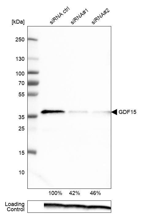 GDF-15 Antibody (CL0328) - Azide and BSA Free Western Blot: GDF-15 Antibody [NBP3-43983]