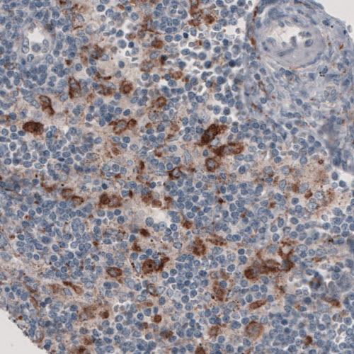 FCRN/FCGRT Antibody (CL3638) - Azide and BSA Free Immunohistochemistry-Paraffin: FCRN/FCGRT Antibody [NBP3-43985]