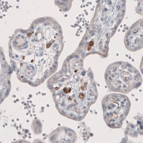 FCRN/FCGRT Antibody (CL3638) - Azide and BSA Free Immunohistochemistry-Paraffin: FCRN/FCGRT Antibody [NBP3-43985]