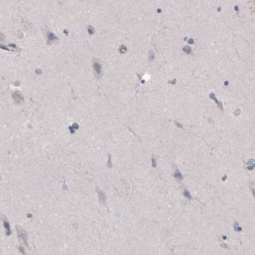 FCRN/FCGRT Antibody (CL3640) - Azide and BSA Free Immunohistochemistry-Paraffin: FCRN/FCGRT Antibody [NBP3-43986]