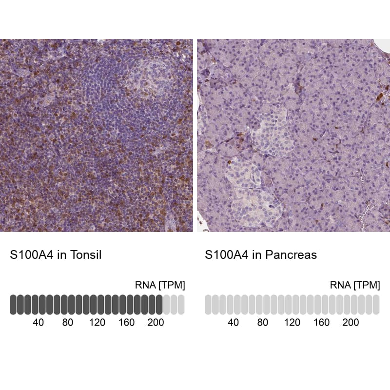S100A4 Antibody (CL0237) - Azide and BSA Free Immunohistochemistry-Paraffin: S100A4 Antibody [NBP3-43987]