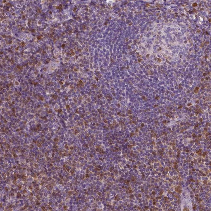 S100A4 Antibody (CL0237) - Azide and BSA Free Immunohistochemistry-Paraffin: S100A4 Antibody [NBP3-43987]