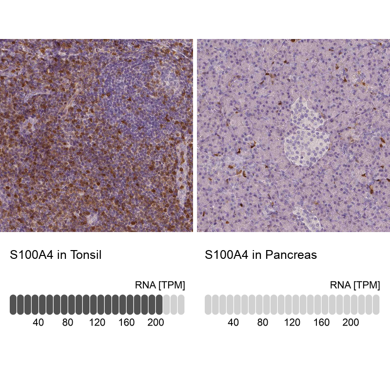 S100A4 Antibody (CL0239) - Azide and BSA Free Immunohistochemistry-Paraffin: S100A4 Antibody [NBP3-43988]