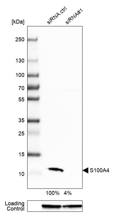 S100A4 Antibody (CL0239) - Azide and BSA Free Western Blot: S100A4 Antibody [NBP3-43988]