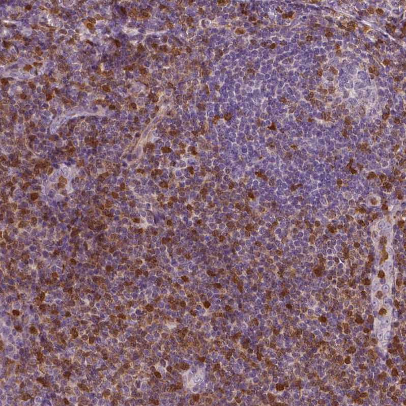 S100A4 Antibody (CL0239) - Azide and BSA Free Immunohistochemistry-Paraffin: S100A4 Antibody [NBP3-43988]