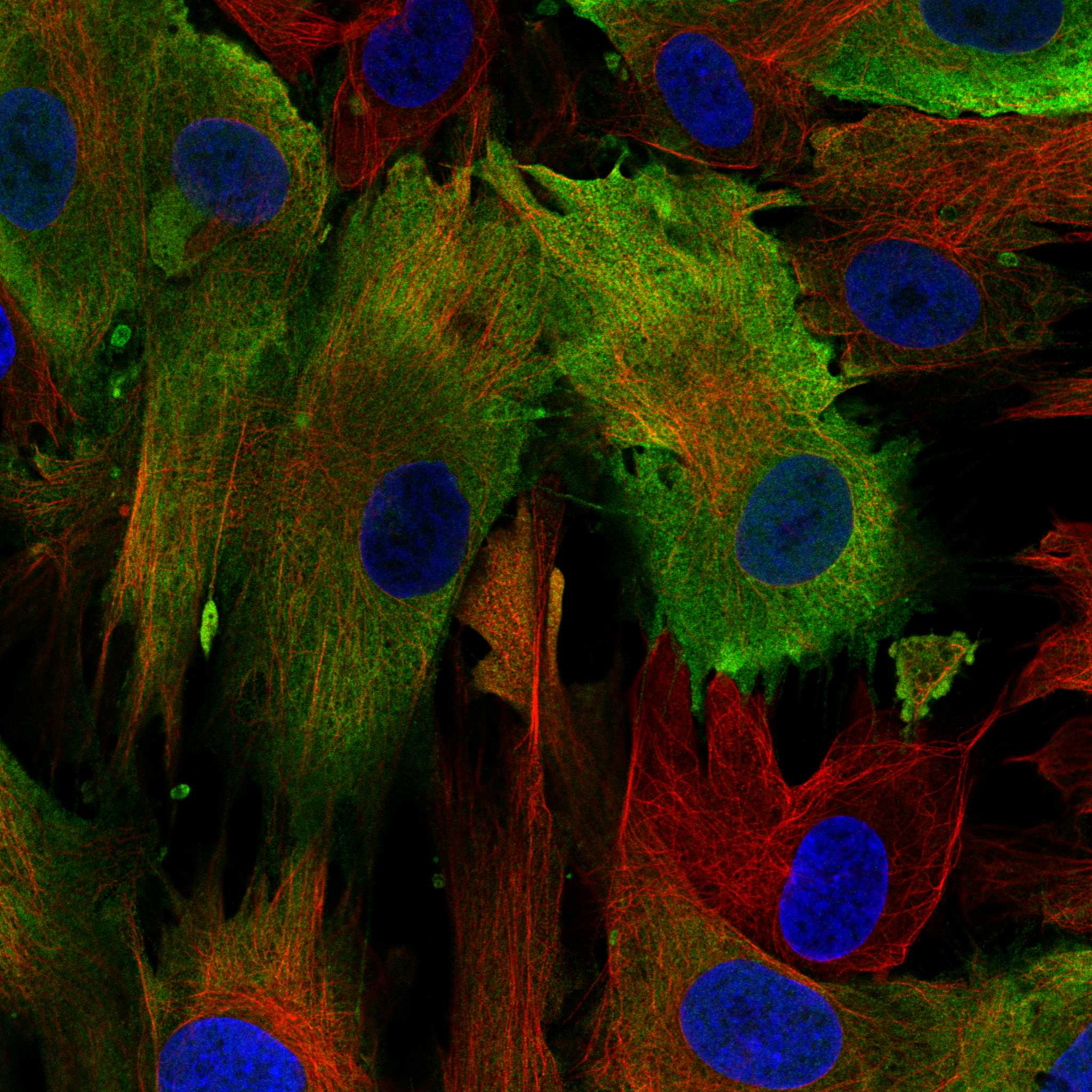 S100A4 Antibody (CL0240) - Azide and BSA Free Immunocytochemistry/ Immunofluorescence: S100A4 Antibody [NBP3-43989]