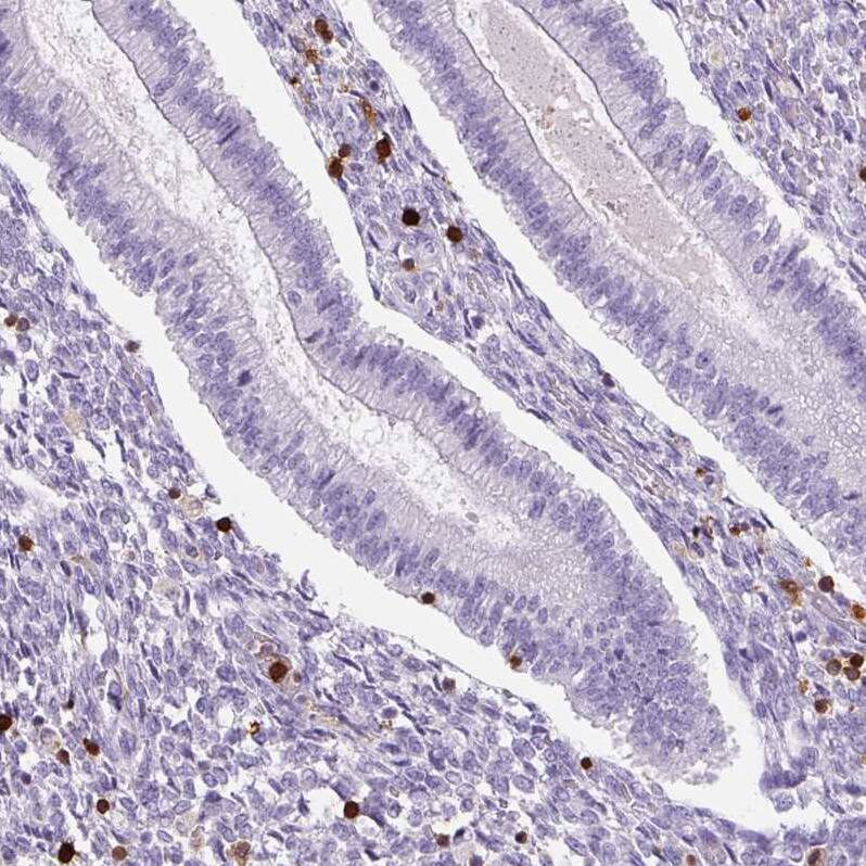 S100A4 Antibody (CL0240) - Azide and BSA Free Immunohistochemistry-Paraffin: S100A4 Antibody [NBP3-43989]