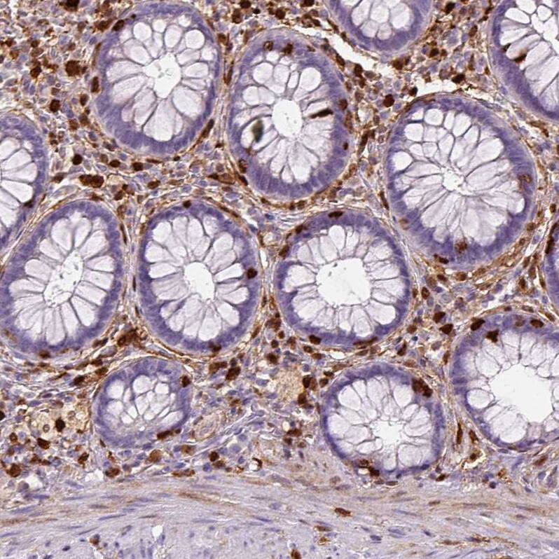 S100A4 Antibody (CL0240) - Azide and BSA Free Immunohistochemistry-Paraffin: S100A4 Antibody [NBP3-43989]