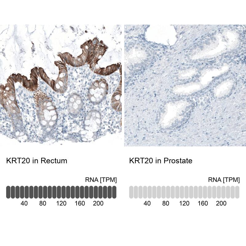 Cytokeratin 20 Antibody (CL9390) - Azide and BSA Free Immunohistochemistry-Paraffin: Cytokeratin 20 Antibody [NBP3-43990]