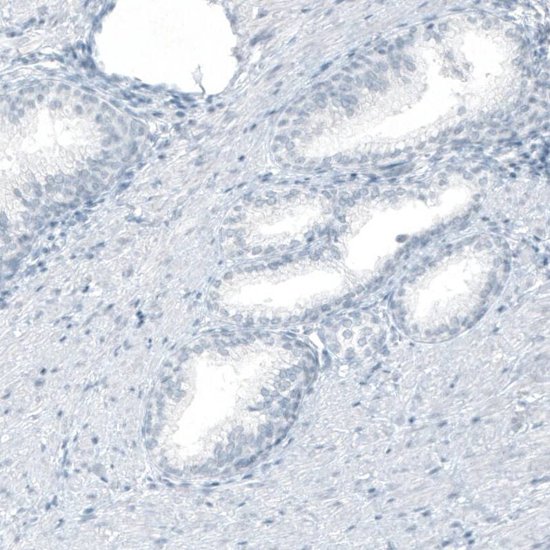 Cytokeratin 20 Antibody (CL9390) - Azide and BSA Free Immunohistochemistry-Paraffin: Cytokeratin 20 Antibody [NBP3-43990]