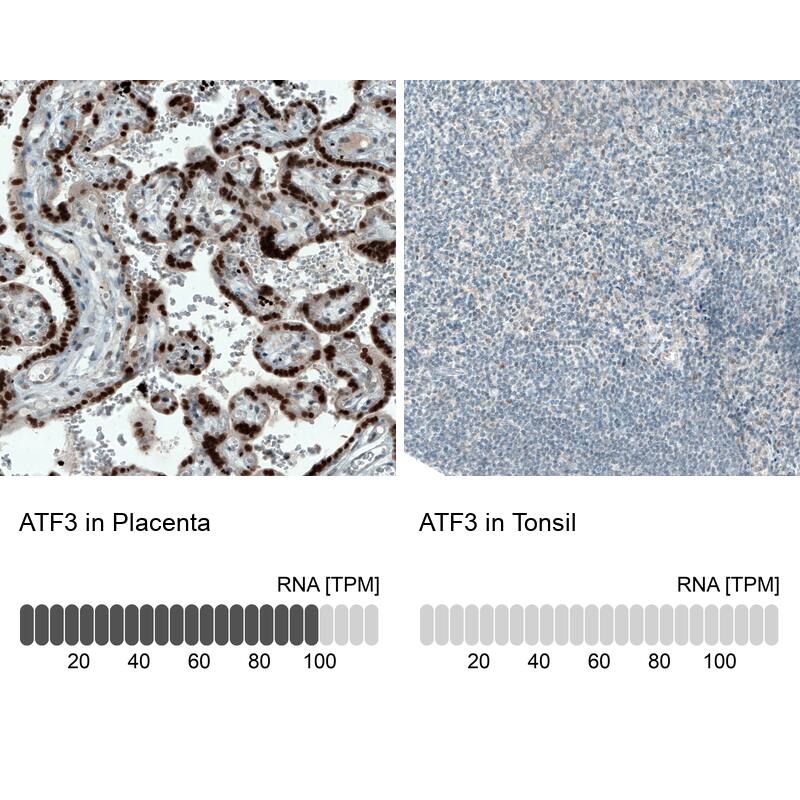 ATF3 Antibody (CL1685) - Azide and BSA Free Immunohistochemistry-Paraffin: ATF3 Antibody [NBP3-43991]