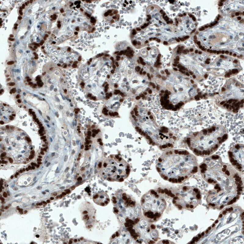ATF3 Antibody (CL1685) - Azide and BSA Free Immunohistochemistry-Paraffin: ATF3 Antibody [NBP3-43991]