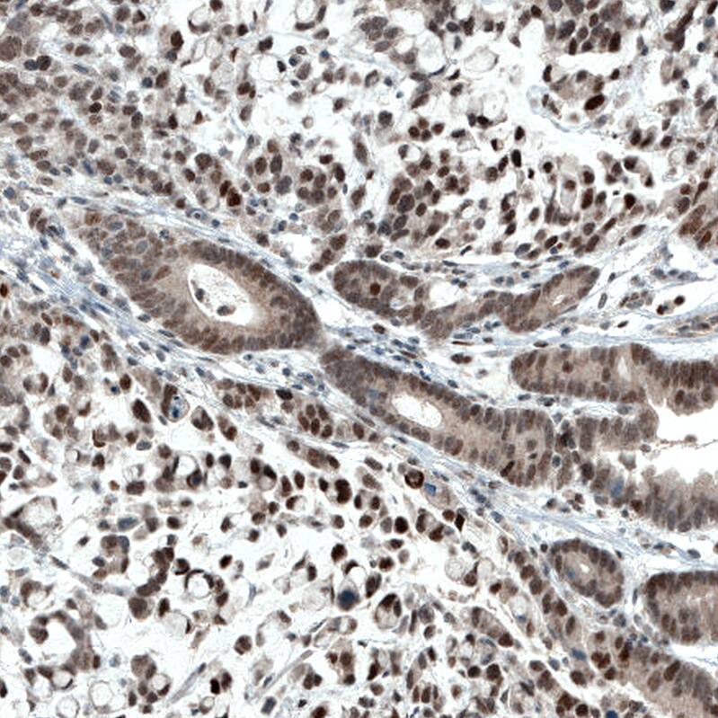 ATF3 Antibody (CL1685) - Azide and BSA Free Immunohistochemistry-Paraffin: ATF3 Antibody [NBP3-43991]