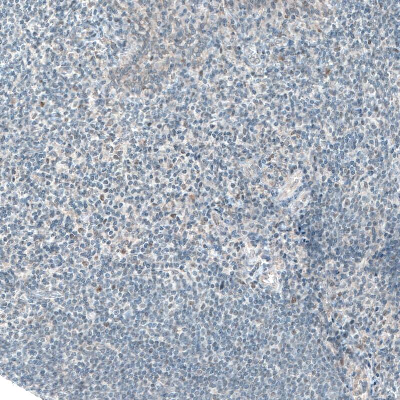 ATF3 Antibody (CL1685) - Azide and BSA Free Immunohistochemistry-Paraffin: ATF3 Antibody [NBP3-43991]