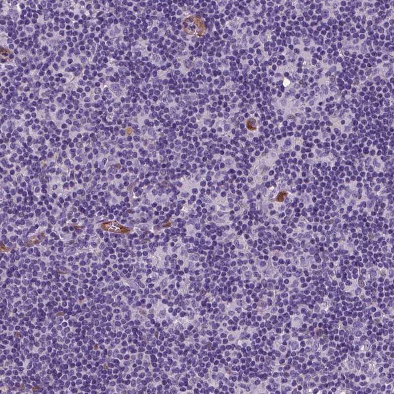 TAZ/WWTR1 Antibody (CL0371) - Azide and BSA Free Immunohistochemistry-Paraffin: TAZ/WWTR1 Antibody [NBP3-43993]