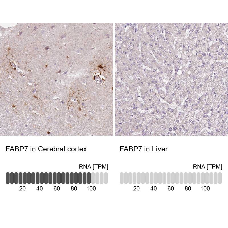 FABP7/B-FABP Antibody (CL0236) - Azide and BSA Free Immunohistochemistry-Paraffin: FABP7/B-FABP Antibody [NBP3-43995]