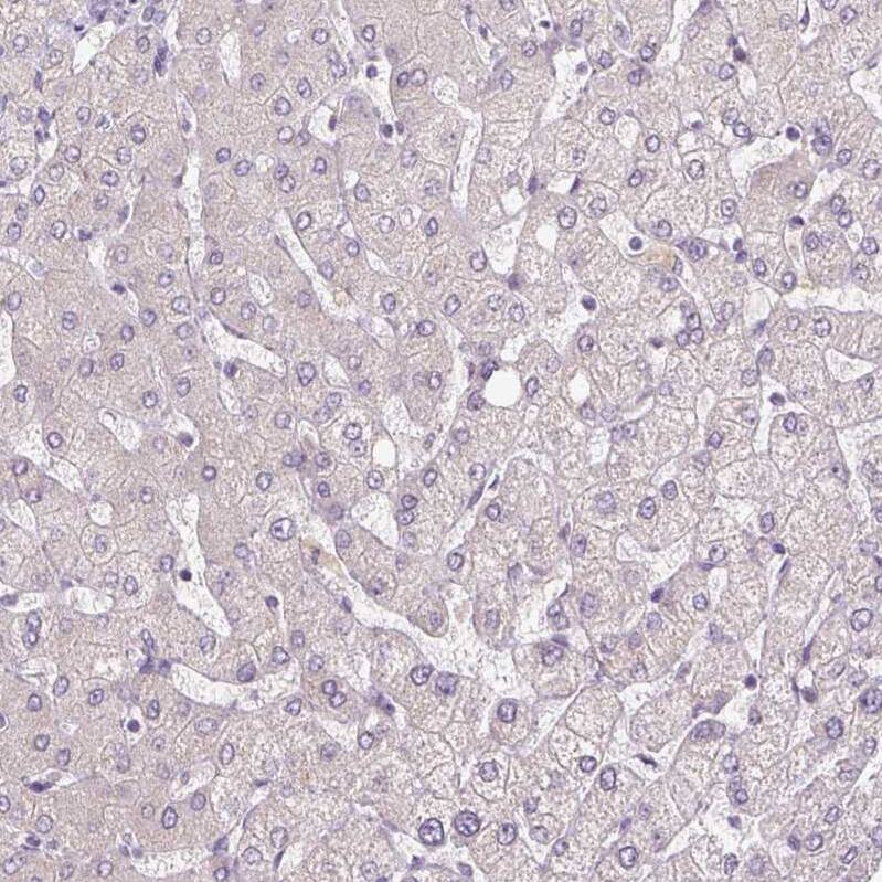 FABP7/B-FABP Antibody (CL0236) - Azide and BSA Free Immunohistochemistry-Paraffin: FABP7/B-FABP Antibody [NBP3-43995]