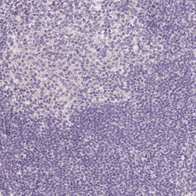 FABP7/B-FABP Antibody (CL0236) - Azide and BSA Free Immunohistochemistry-Paraffin: FABP7/B-FABP Antibody [NBP3-43995]