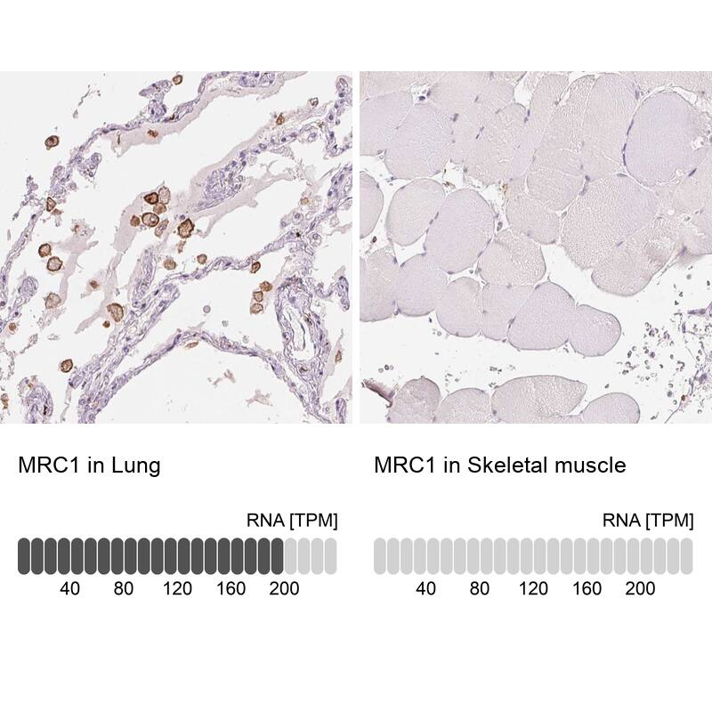 MMR/CD206/Mannose Receptor Antibody (CL0387) - Azide and BSA Free Immunohistochemistry-Paraffin: MMR/CD206/Mannose Receptor Antibody [NBP3-43996]