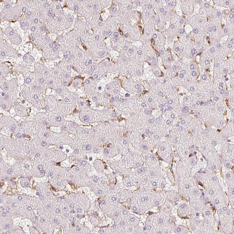 MMR/CD206/Mannose Receptor Antibody (CL0387) - Azide and BSA Free Immunohistochemistry-Paraffin: MMR/CD206/Mannose Receptor Antibody [NBP3-43996]