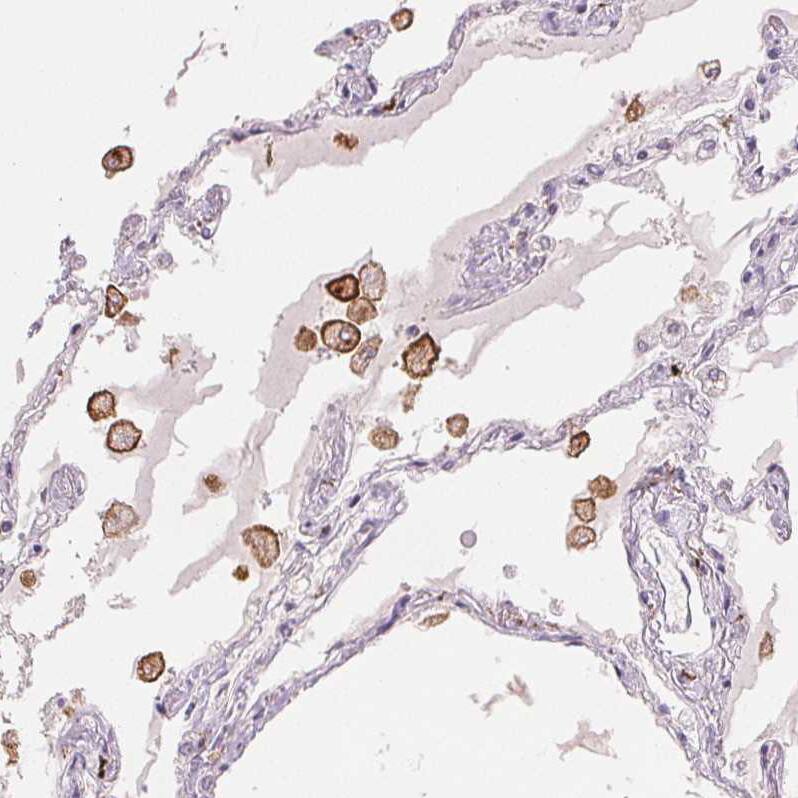 MMR/CD206/Mannose Receptor Antibody (CL0387) - Azide and BSA Free Immunohistochemistry-Paraffin: MMR/CD206/Mannose Receptor Antibody [NBP3-43996]