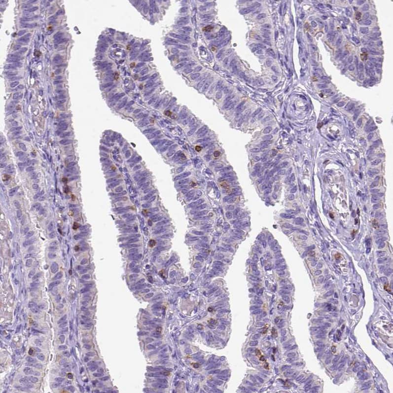 CD3 epsilon Antibody (CL1466) - Azide and BSA Free Immunohistochemistry-Paraffin: CD3 epsilon Antibody [NBP3-43997]