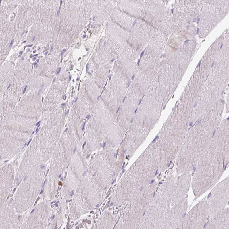 CD3 epsilon Antibody (CL1466) - Azide and BSA Free Immunohistochemistry-Paraffin: CD3 epsilon Antibody [NBP3-43997]