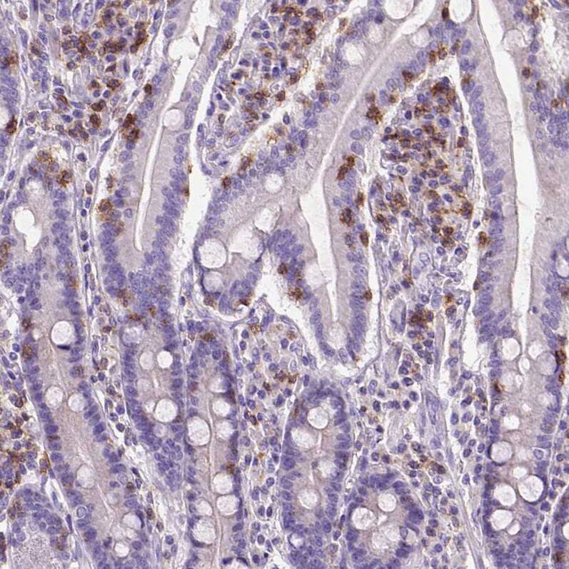 CD3 epsilon Antibody (CL1466) - Azide and BSA Free Immunohistochemistry-Paraffin: CD3 epsilon Antibody [NBP3-43997]