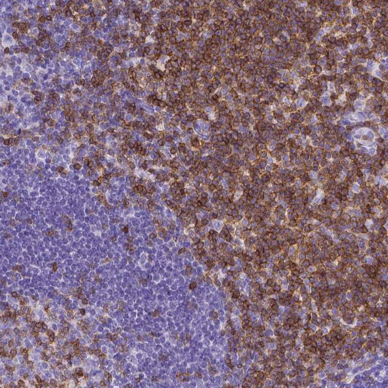 CD3 epsilon Antibody (CL1497) - Azide and BSA Free Immunohistochemistry-Paraffin: CD3 epsilon Antibody [NBP3-43998]
