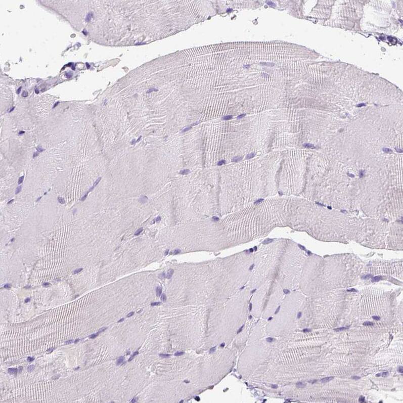 CD3 epsilon Antibody (CL1497) - Azide and BSA Free Immunohistochemistry-Paraffin: CD3 epsilon Antibody [NBP3-43998]