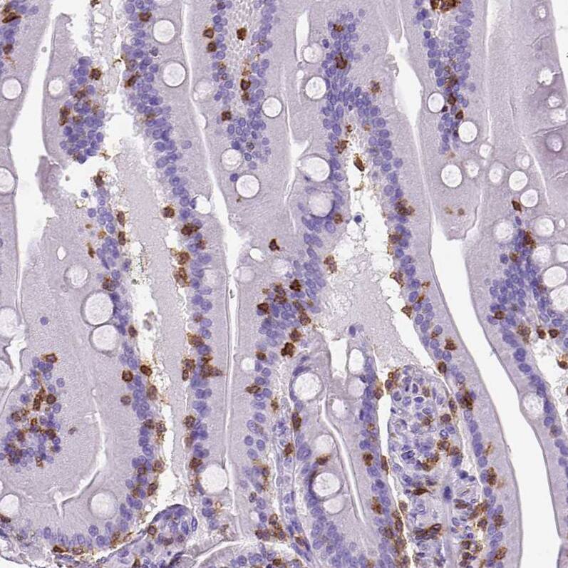 CD3 epsilon Antibody (CL1497) - Azide and BSA Free Immunohistochemistry-Paraffin: CD3 epsilon Antibody [NBP3-43998]