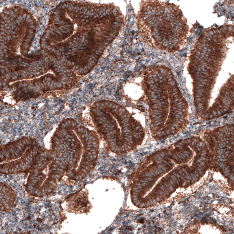 LAMP-1/CD107a Antibody (CL3484) - Azide and BSA Free Immunohistochemistry-Paraffin: LAMP-1/CD107a Antibody [NBP3-43999]