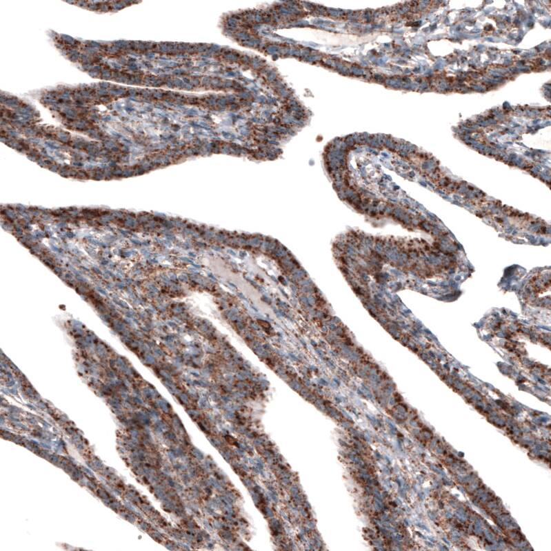 LAMP-1/CD107a Antibody (CL3484) - Azide and BSA Free Immunohistochemistry-Paraffin: LAMP-1/CD107a Antibody [NBP3-43999]