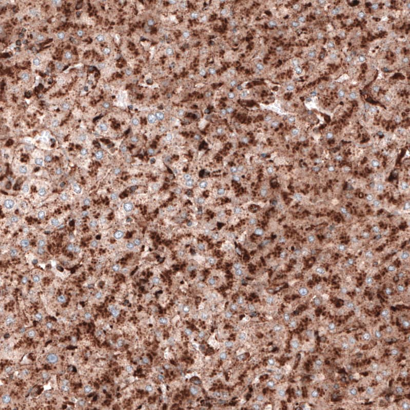 LAMP-1/CD107a Antibody (CL3484) - Azide and BSA Free Immunohistochemistry-Paraffin: LAMP-1/CD107a Antibody [NBP3-43999]